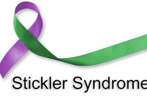 Understanding Stickler Syndrome and Hearing Loss